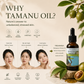TREEANNSEA Madagascar Tamanu Oil original 30ml