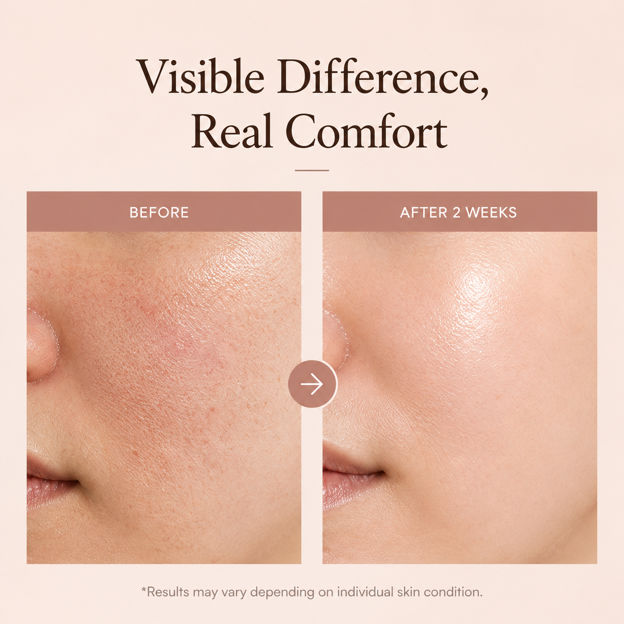 [NEW 26.07]TREEANNSEA Desert Rose Cream 50g, korean skincare